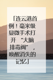 连云港首例！毫米级显微手术打开 “大脑排毒阀”，唤醒消失的记忆